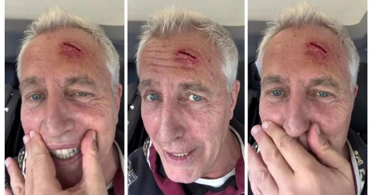 Marley sufrió un fuerte accidente: se golpeó la cabeza y terminó en el hospital