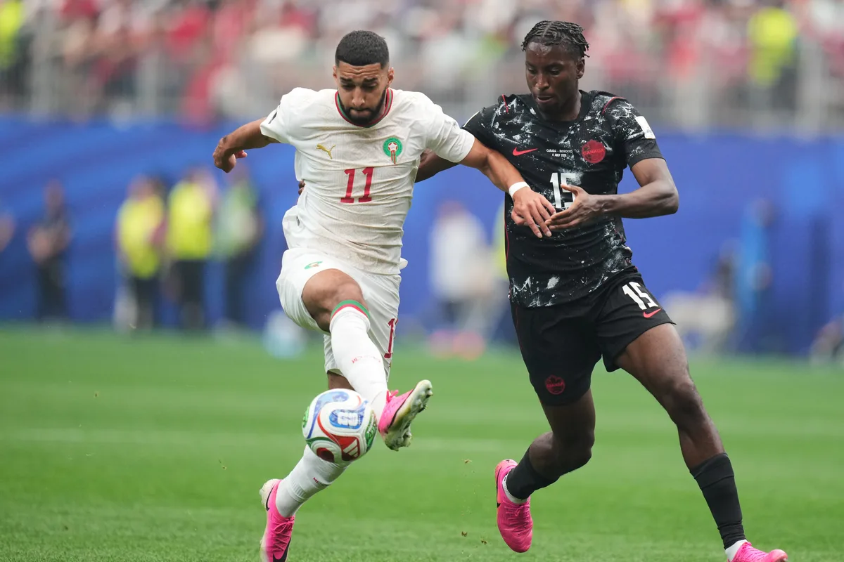 Bombito set for second surgery on left tibia after ‘struggling’ through World Cup