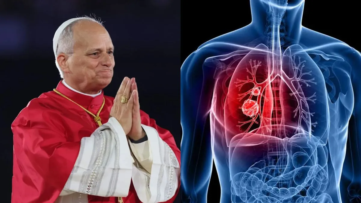 Cómo será la operación del papa León XIV por un nódulo pulmonar y cuánto tiempo tardará en recuperarse