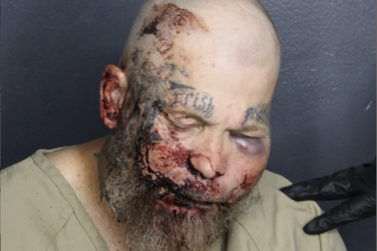 Horrific mugshot shows injuries of Florida man who is accused of attacking cop in the hospital