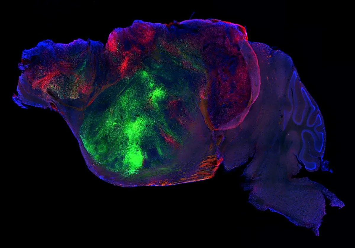 Científicos injertan neuronas humanas en ratones con medio cerebro y recuperan sus capacidades