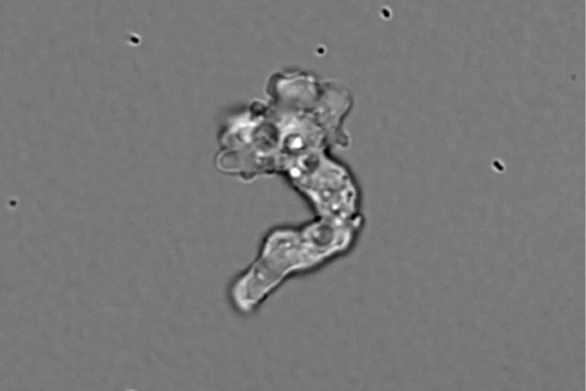 Say Hello to the ‘Fire Amoeba.’ It Just Broke a Heat Limit Scientists Thought Was Impossible