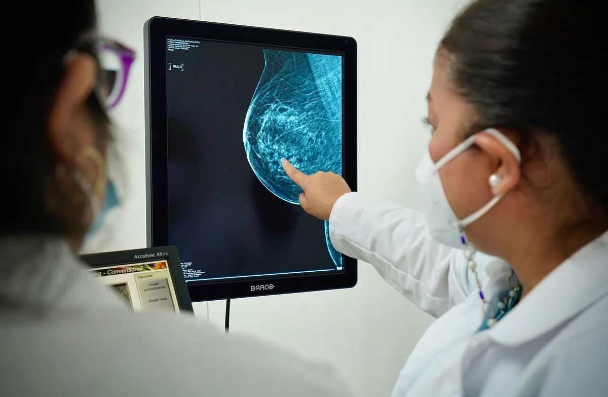 Sonora registra la mayor tasa de mortalidad por cáncer de mama en México; fallecen 27 mujeres por cada 100 mil habitantes