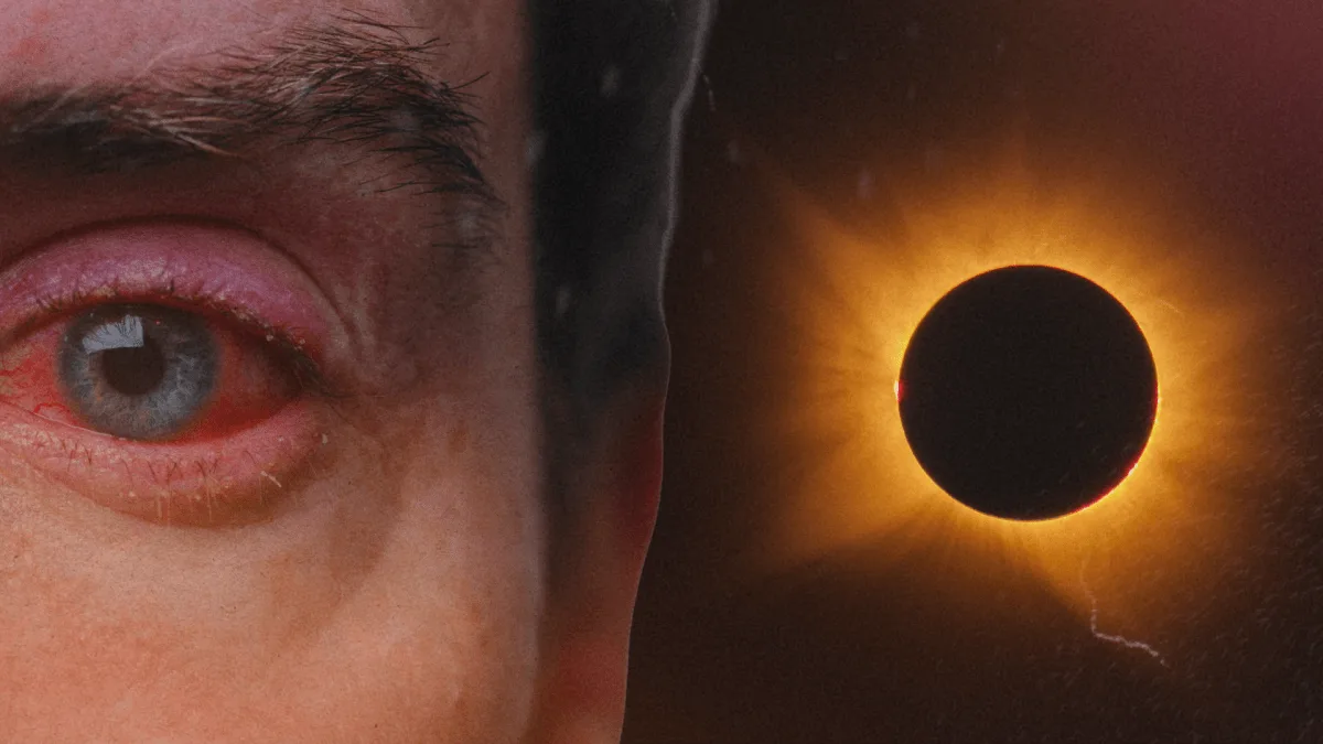 Vous avez mal aux yeux après l’éclipse ? La douleur n’est pas forcément le symptôme le plus inquiétant
