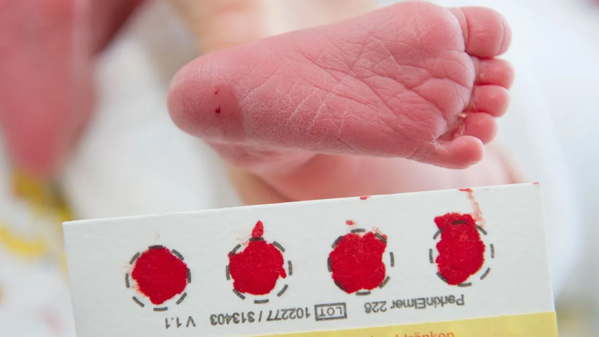 Medizin: 281 Mukoviszidose-Diagnosen bei Neugeborenen