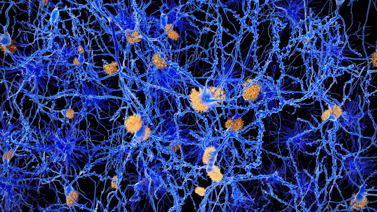 Schlaf und Neurologie: Ein neues Medikament gegen Narkolepsie wird zur Hoffnung der Hirnforschung