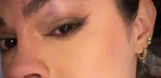 Prefeito é acusado de agredir esposa que pediu separação e deixa o PT em PE
