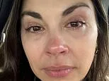 I thought sleeping with my make-up on was harmless. Now I've got this terrifying condition that affects 1 in 5 people. Doctors say it's too late for me - I'm going to suffer this agony for life. Don't make my mistake