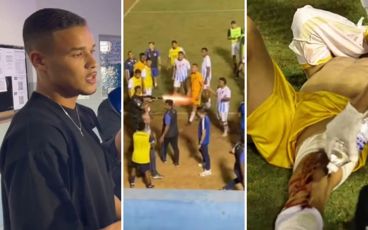 Goleiro atingido por tiro de bala de borracha de policial após jogo deve ser indenizado em cerca de R$ 100 mil; vídeo mostra tiro