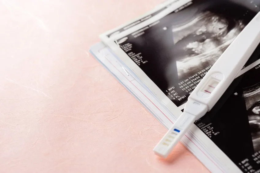 Research exposes deadly gaps in care for ectopic pregnancies