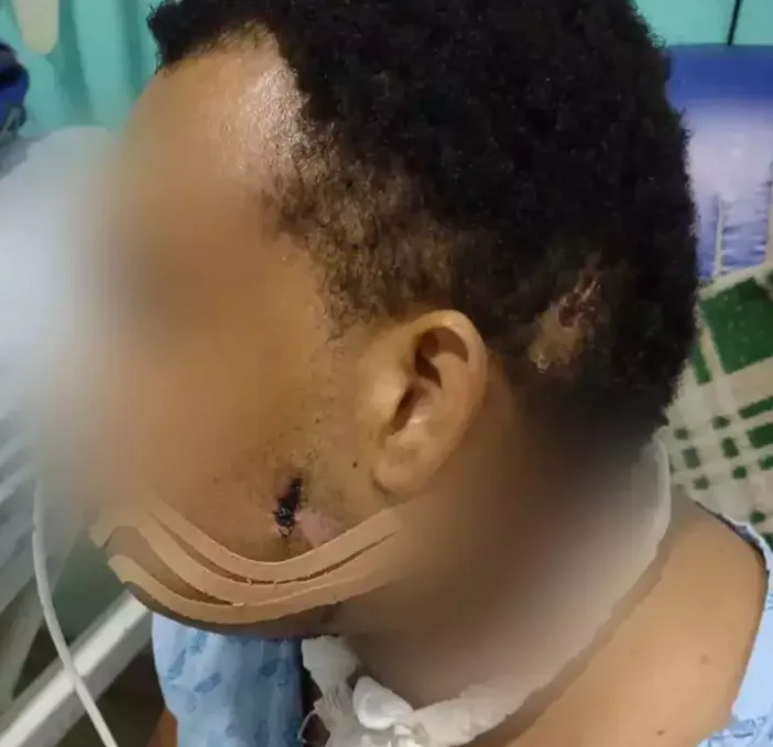 Baleado ao tomar tereré integrava grupo que torturou homem por dívida de drogas
