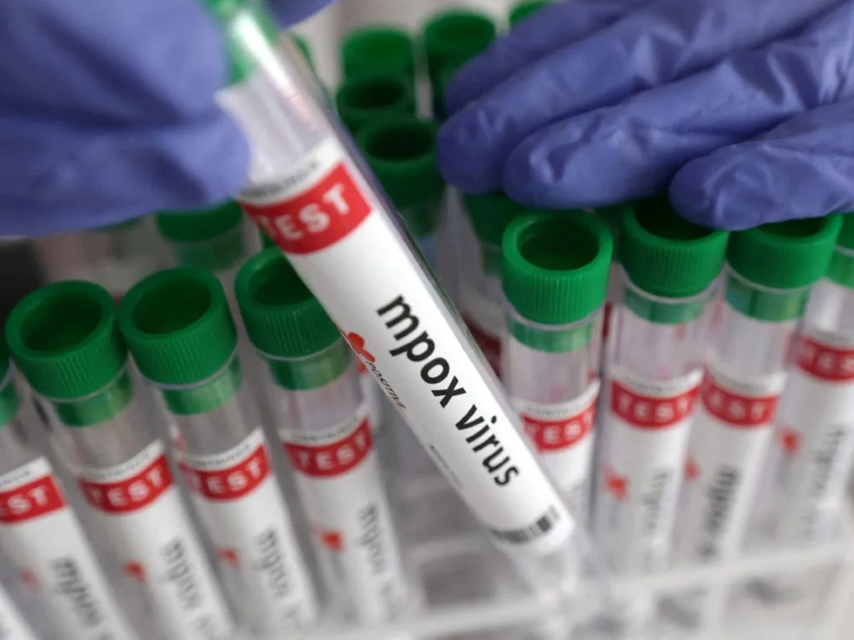 Gauteng activates Mpox response teams after three confirmed cases