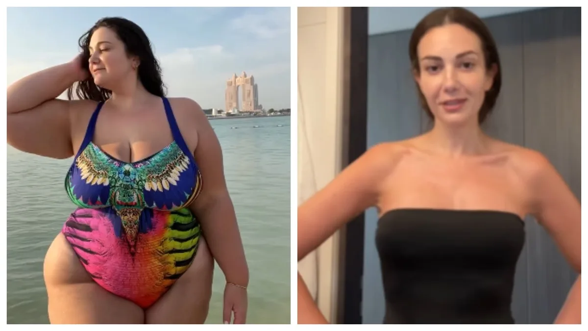 Influencer de body positive recibe críticas tras bypass gástrico y perder más de 70 kilos: “Yo elijo vivir para MÍ”