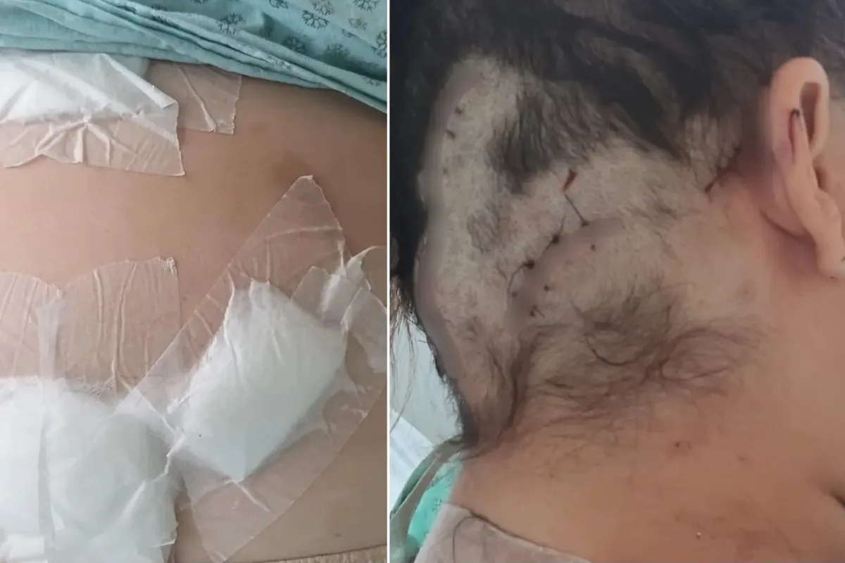 Homem é preso no Ceará após tentar matar a ex com 12 facadas