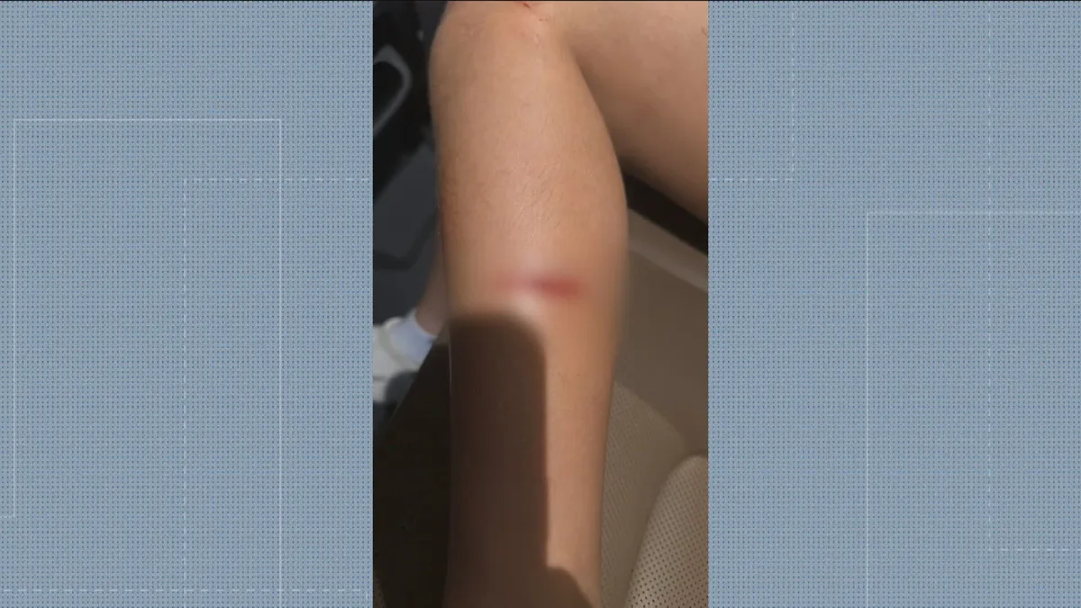 Menina de 11 anos é atropelada por moto na calçada ao sair de aula de dança no Grajaú, Zona Norte do Rio