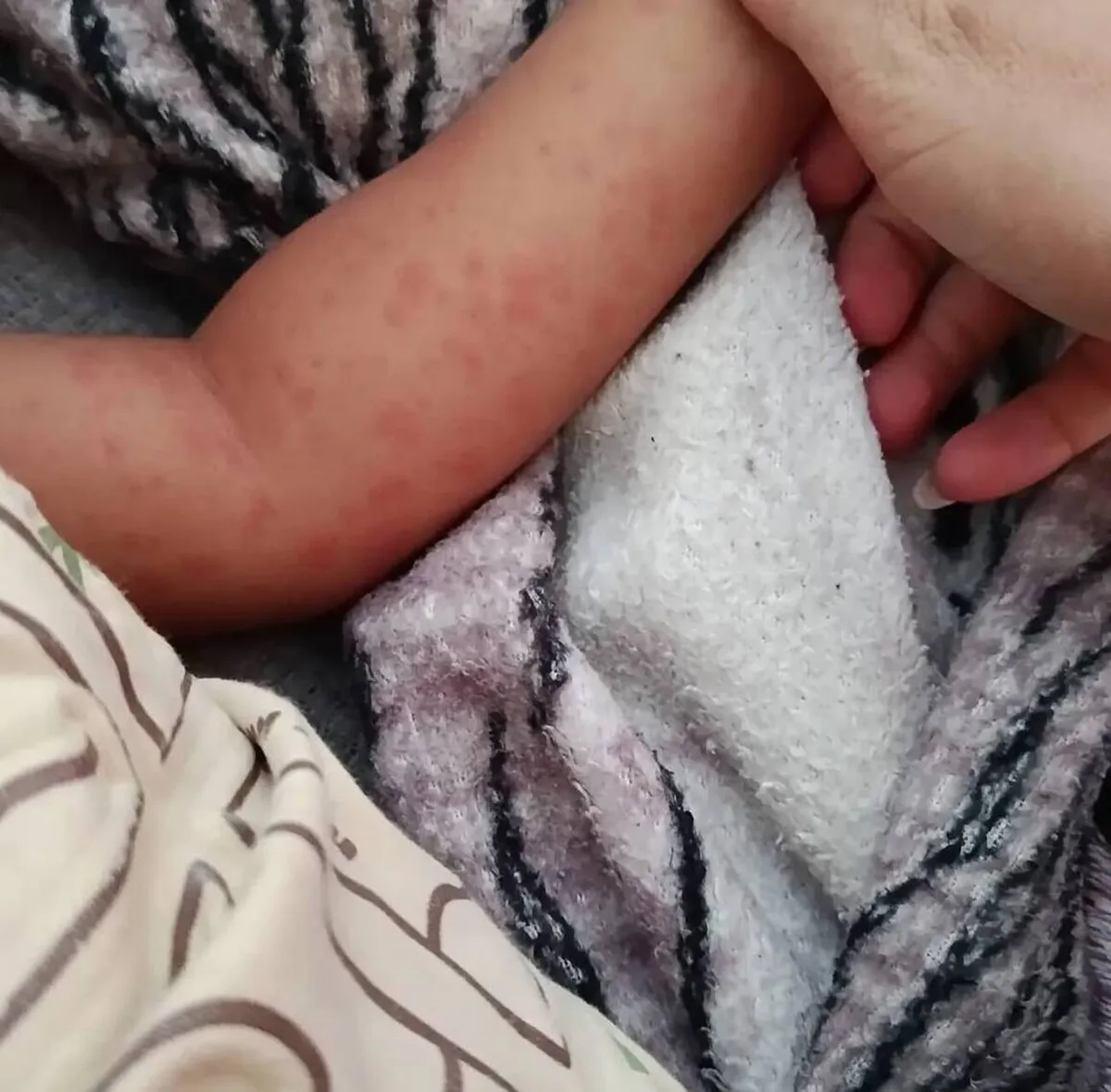Criança morre por suspeita de febre maculosa em Três Rios