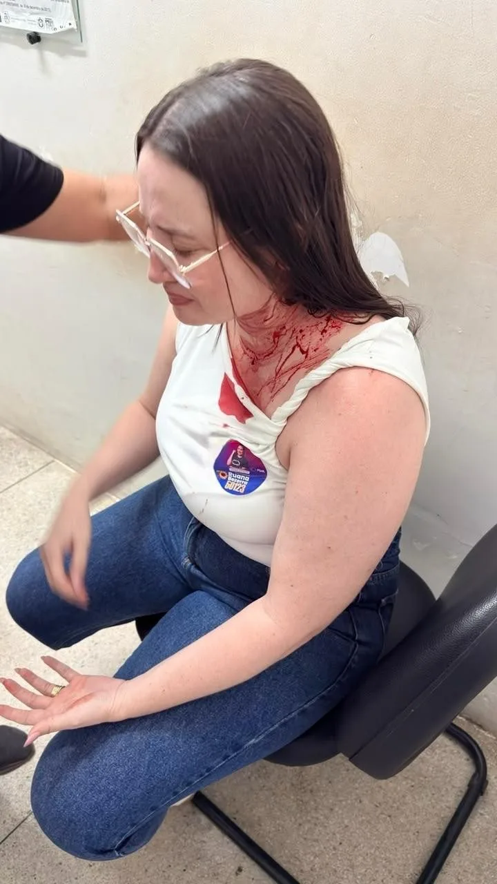 Candidata a deputada estadual em Pernambuco é atacada com pedra em caminhada no Sertão