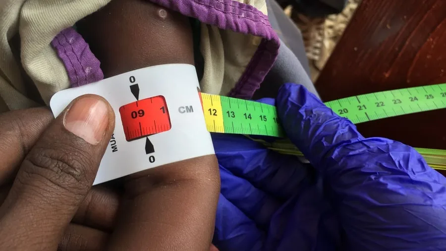 Drohender Hunger: Bericht sieht Risiko einer Hungersnot in Teilen Somalias