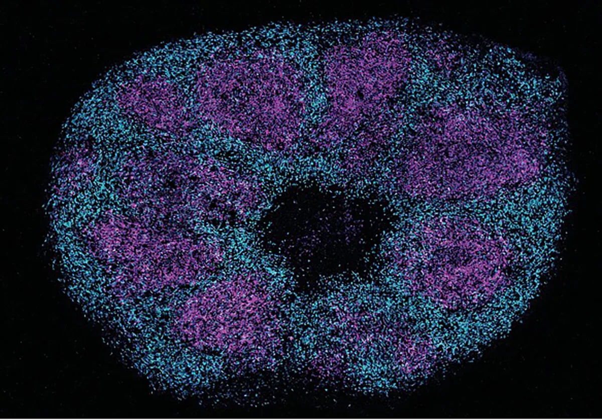 Un estudio de las proteínas cerebrales despierta optimismo ante nuevos tratamientos para el autismo