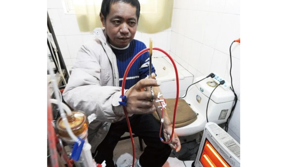 In 2013, a Chinese man who could no longer afford dialysis built his own dialysis machine