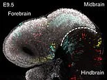 Now that's what you call mind-blowing! The human brain is TWO separate organs, scientists reveal