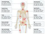 E-scooters are even MORE dangerous than motorbikes: Shocking figures reveal how riders are at higher risk of brain and organ injuries - yet just 6% wear a helmet