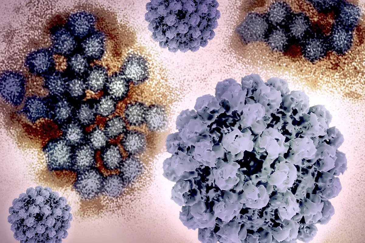 Bride and groom bedridden for days after norovirus-tainted wedding meal, lawsuit says
