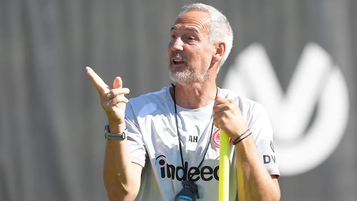 Welche Konsequenzen er zieht - Hütter greift knallhart bei Eintracht durch