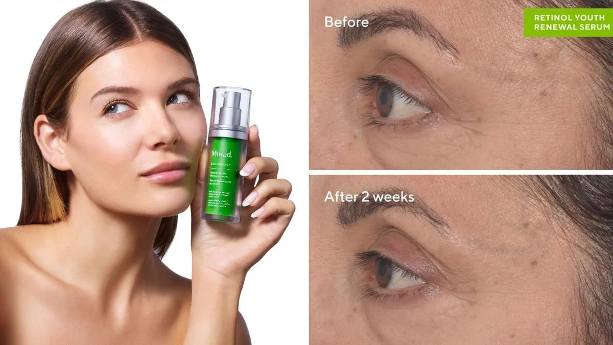 Global best-selling retinol by Murad gets even better with advanced beauty tech