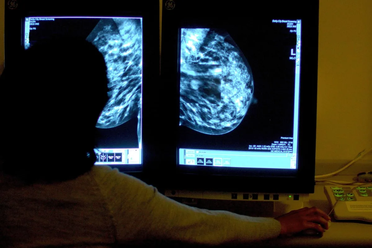 NHS: 20 women had unnecessary mastectomies, while others suffered harm