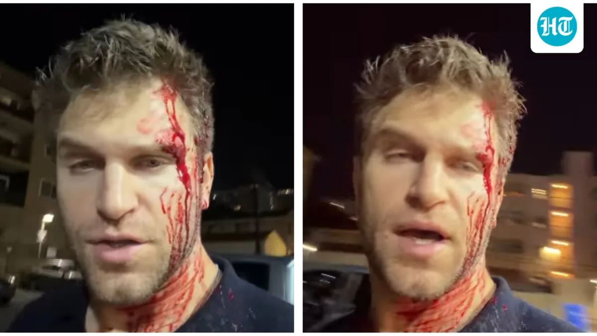 Pretty Little Liars star Keegan Allen robbed and beaten at gunpoint outside grocery store: ‘West Hollywood is not safe anymore’