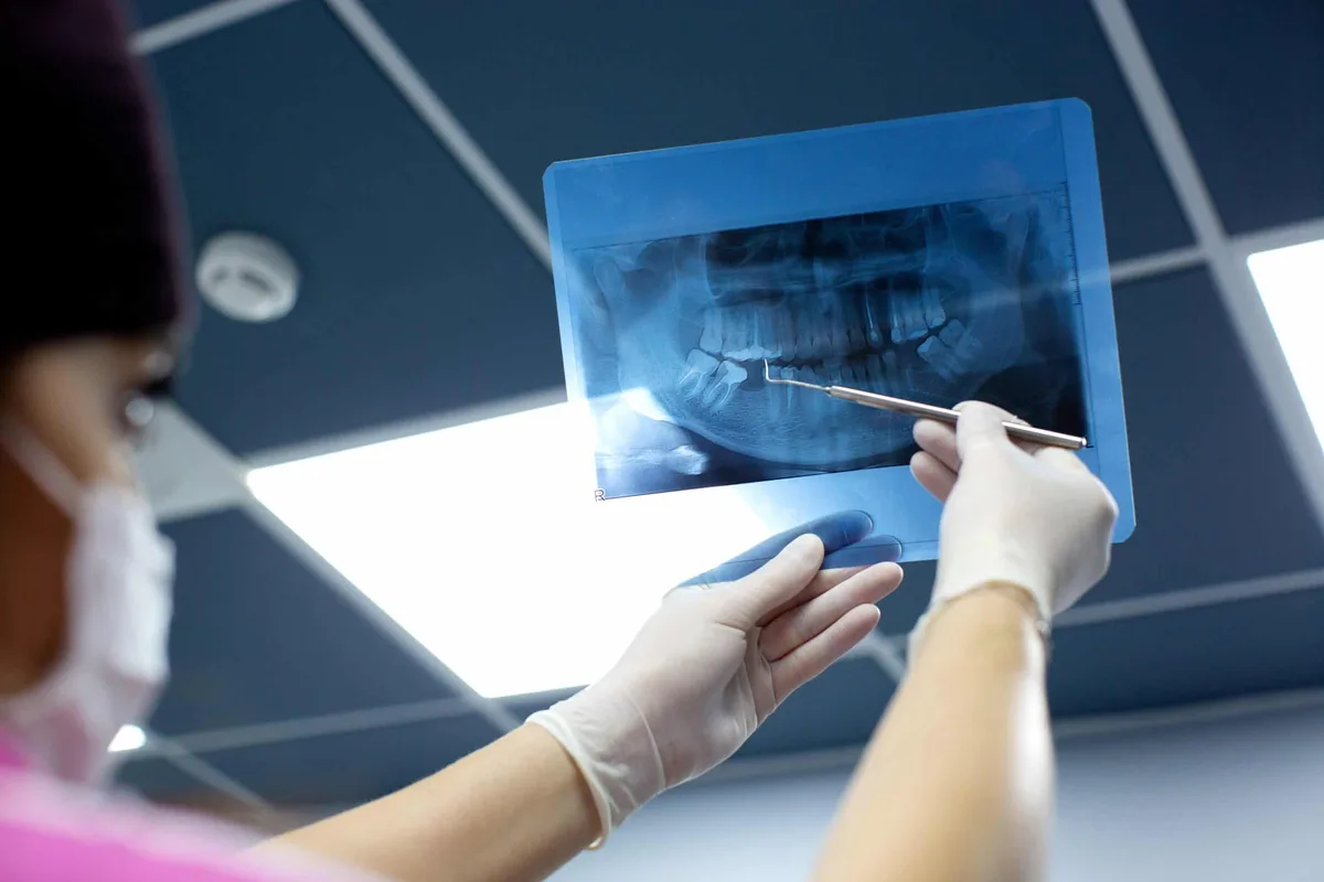 IA brasileira promete acelerar diagnósticos em tratamento dentário