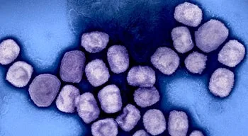 Portugal registou transmissão comunitária de monkeypox e 66 casos de infeção recentes