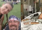 Homem cai de árvore sobre mulher durante festival e a deixa paraplégica