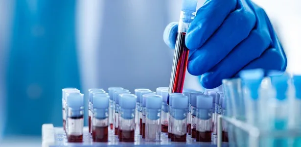 Biorrepositório brasileiro pode ajudar a personalizar a prevenção do câncer no SUS
