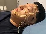 Brain-zapping patch to help sleep could also ease anxiety