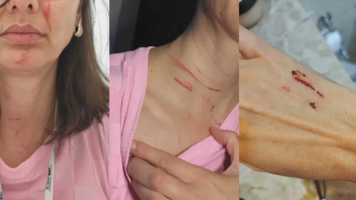 Enfermeira denuncia ter sido agredida em plantão no hospital de Samambaia, no DF