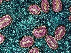 Übertragung von Mensch zu Mensch: Studie: Spermien können Mpox-Infektionen begünstigen
