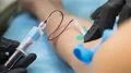 Desarrollan un análisis de sangre que podría detectar la recurrencia del cáncer de mama