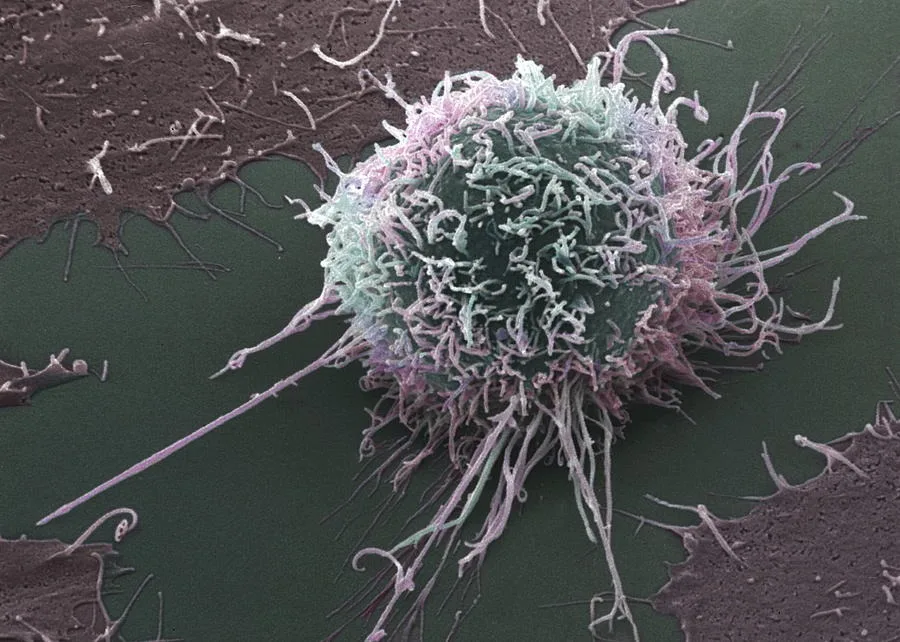 THE CONVERSATION: SA scientists decode cancer’s ‘cloak of invisibility’ in ‘major leap forward’