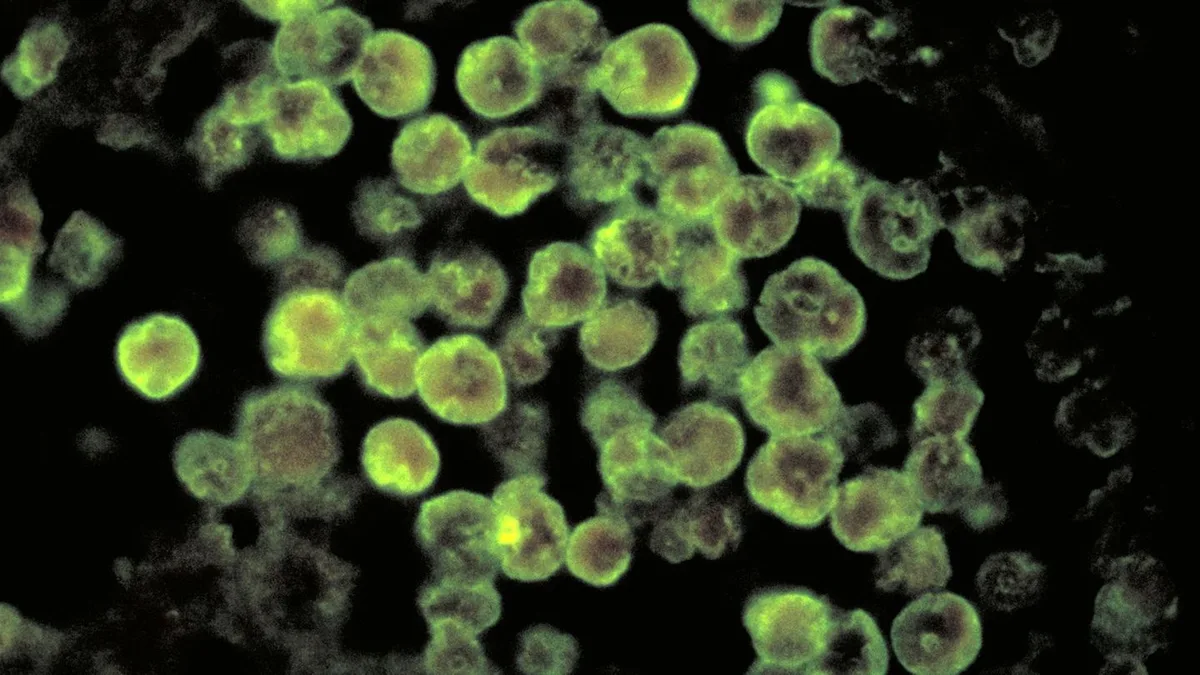 „Naegleria fowleri“: Achtjähriges Mädchen stirbt nach Infektion mit gehirnfressender Amöbe