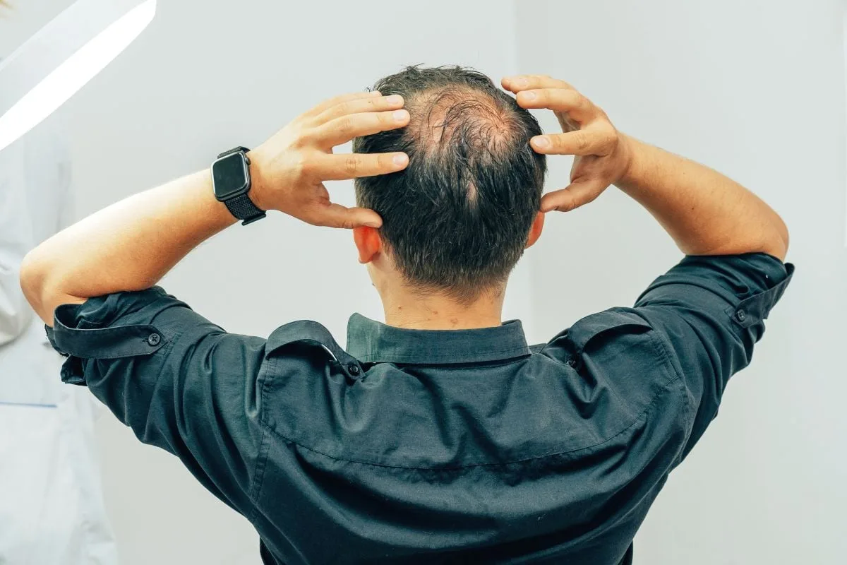 Ni minoxidil ni lociones: el champú con cafeína Nº1 en Amazon que previene la caída del cabello