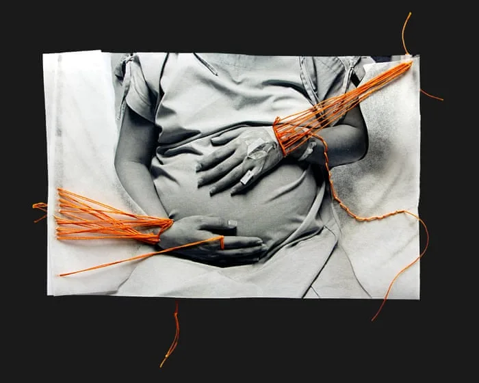 Shackling prisoners giving birth should be a last resort – but it’s happening around Australia anyway