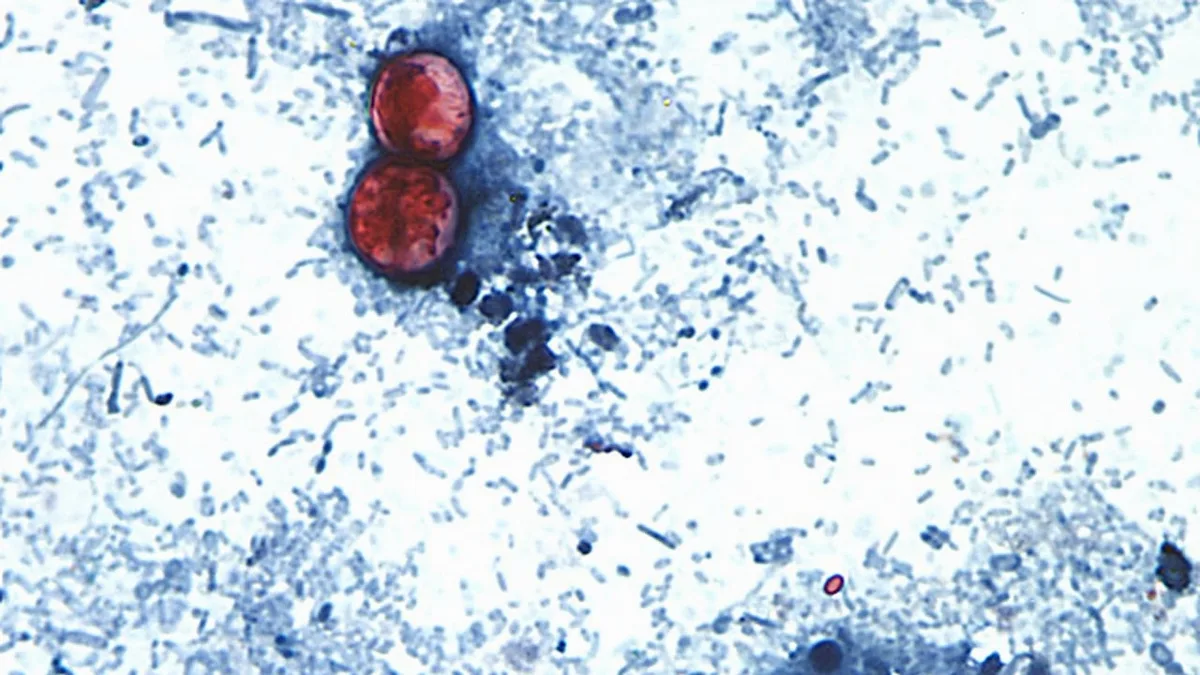 U.S. federal officials declare end to cyclospora outbreak that sickened thousands in 21 states
