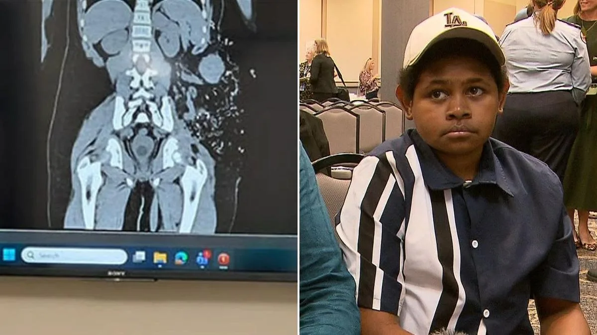 ‘There was blood everywhere’: The moment 14-year-old Sam Nai’s life changed after Thursday Island shark attack
