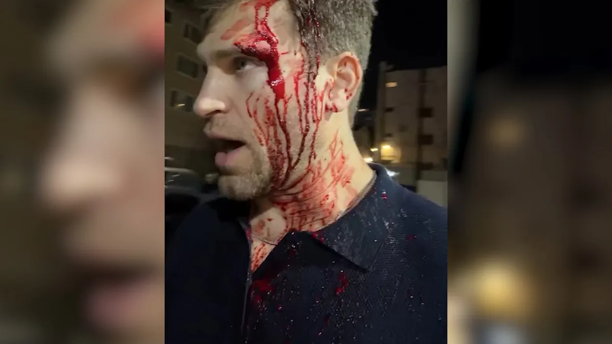 Sie kamen mit Waffe und Messer - Brutaler Überfall auf US-Serienstar