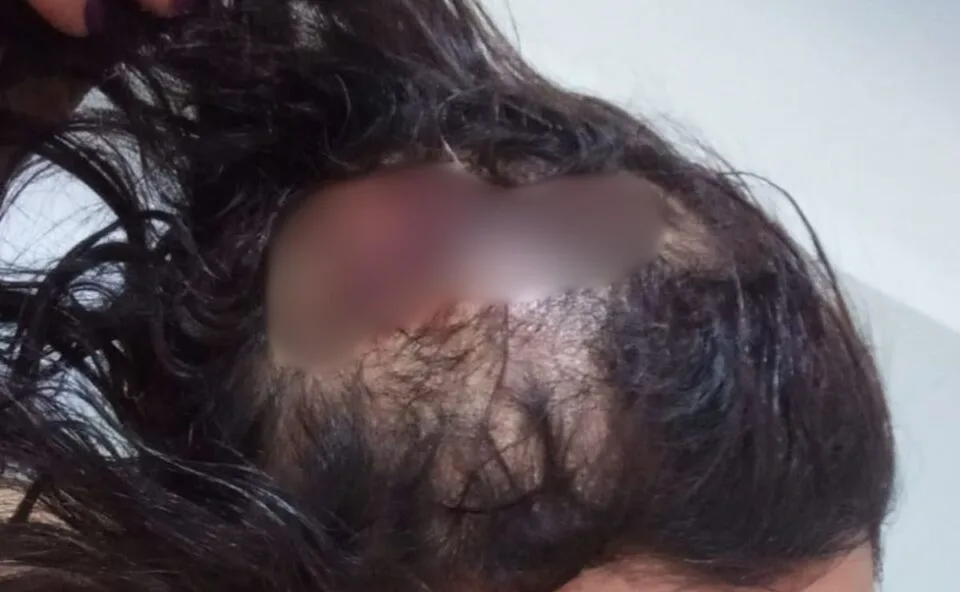 Mulher fica gravemente ferida ao ser agredida pelo namorado com pedaço de madeira; suspeito foi preso