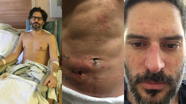 Joe Manganiello expõe fotos de como ficou após “doença misteriosa mortal” e choca fãs; imagens fortes Joe Manganiello expõe fotos de como ficou após “doença misteriosa mortal” e choca fãs; imagens fortes