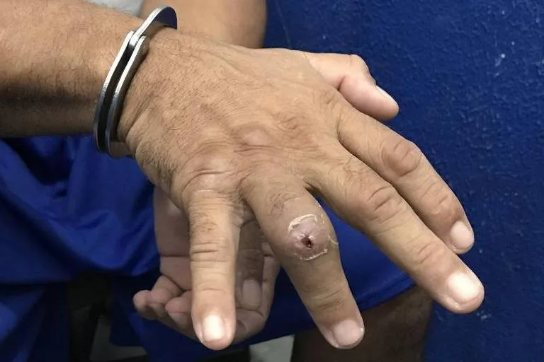 Policiais do Ceará são condenados por torturar presos com técnica do 'quebra-dedos'