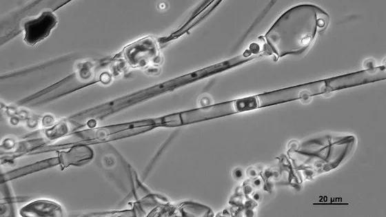 腸内に生息するカビが放射線から体を守る役に立つかもしれない